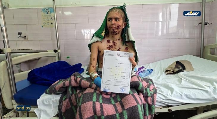 عبد الله الرقب.. رصاصة الاحتلال فجّرت مرضًا نادرًا ينهش جسده وسط عجز طبي في غزة