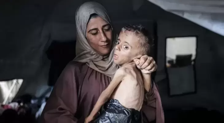 سيدة ترعى طفلها المريض في غزة.webp