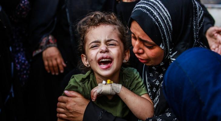 طفل مصاب في غزة.jpg
