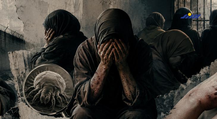 مرض السكابيوس ينتشر في صفوف الأسيرات والقلق يرهق أهاليهن