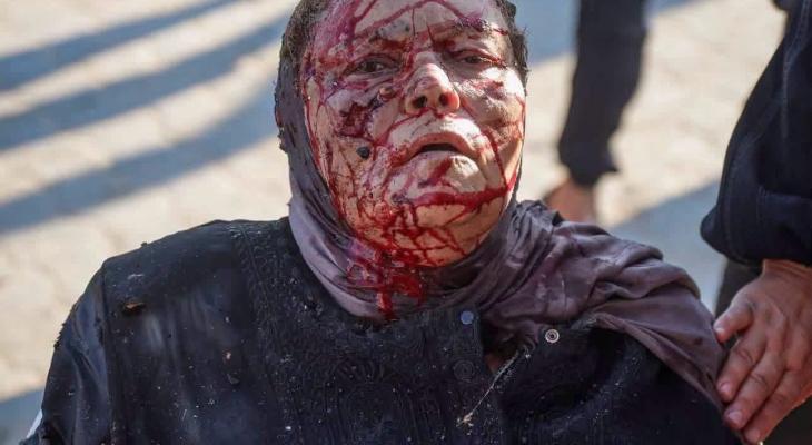 سيدة مصابة إثر مجزرة الميناء بغزة