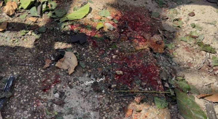 محاولة اغتيال قيادي غرب مدينة غزة
