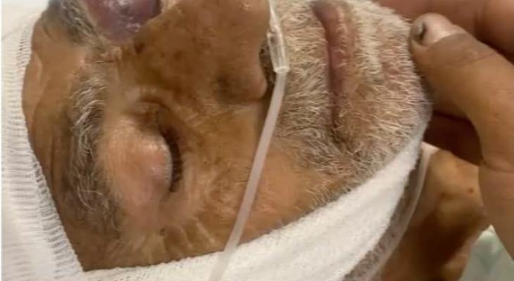 إصابة مسنّ باعتداء للمستوطنين غرب سلفيت