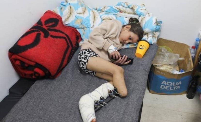 8 آلاف حالة بتر أطراف بغزة بسبب حرب الإبادة