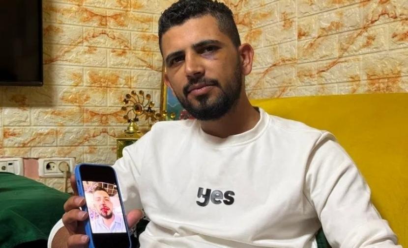 إصابة سائق مقدسي في اعتداء عنصري للمستوطنين