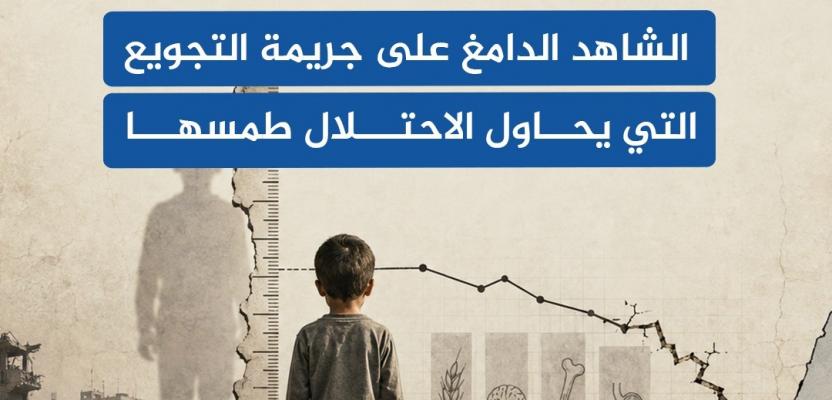 بصمة الجوع المزمن.. أجساد أطفال غزة توثق جريمة التجويع بالتقزم