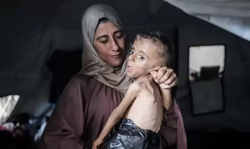 سيدة ترعى طفلها المريض في غزة.webp