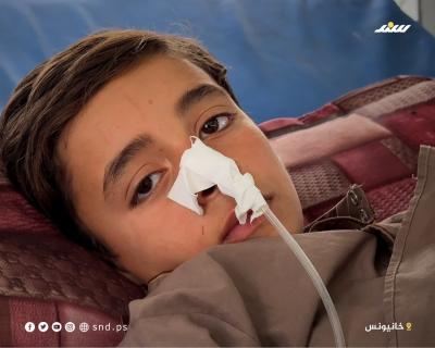 الطفل يزيد مصلح.. ضحية المساعدات الأمريكية 5.jpg