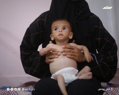 سيلا بربخ.. رضيعة في عامها الأول تهدد المجاعة حياتها3.jpg