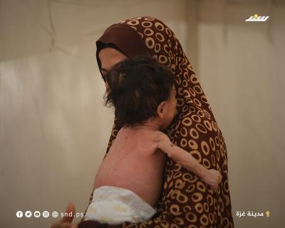 الرضيع سالم عوض.. 6 أشهر من الحياة على حافة الموت بسبب المجاعة (1).jpeg