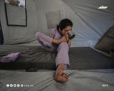 طفولة مبتورة بين الركام... سارة تحارب الألم بقدميها7.jpg