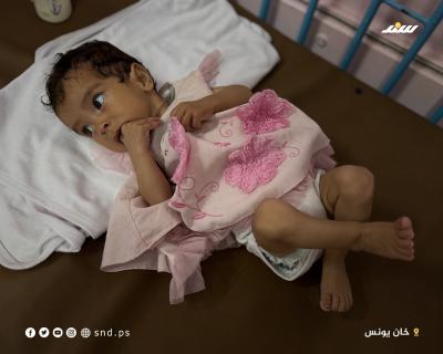 سيلا بربخ.. رضيعة في عامها الأول تهدد المجاعة حياتها4.jpg