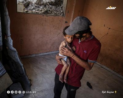 الطفل يزن أبو فول يعاني من سوء التغذية الحاد في ظل استمرار الحصار وشح الغذاء والدواء2.jpg