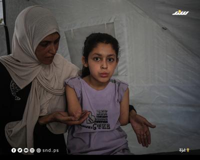 طفولة مبتورة بين الركام... سارة تحارب الألم بقدميها6.jpg