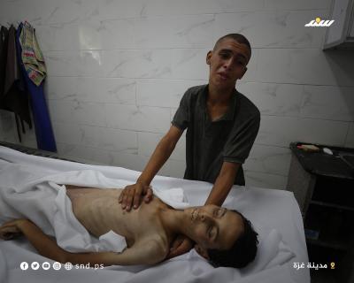 الفتى عاطف أبو خاطر (17 عاما).. ضحية أخرى من وفيات المجاعة بغزة1.jpg