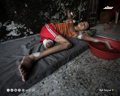 سمير بين الركام.. جسد مبتور وأملٌ بالنجاة5.jpg