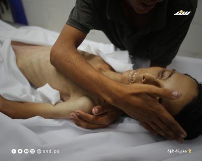 الفتى عاطف أبو خاطر (17 عاما).. ضحية أخرى من وفيات المجاعة بغزة2.jpg