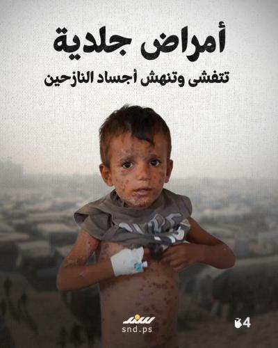 قصة مصورة  جحيم مصغر.. كيف يبدو صيف الإبادة بغزة؟ (1).jpg