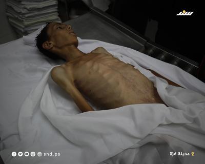 الفتى عاطف أبو خاطر (17 عاما).. ضحية أخرى من وفيات المجاعة بغزة4.jpg