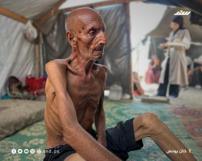 الشيخوخة تحت وطأة المجاعة.. سليم يفقد وزنه ويصارع الجوع في خيمة4.jpg
