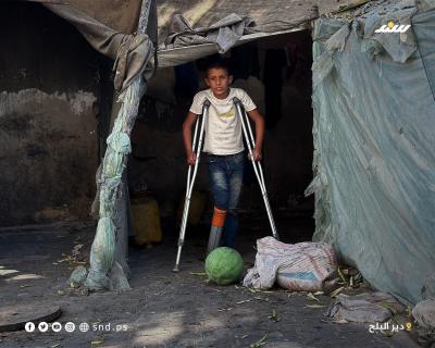 الطفل اليتيم راتب اقليق.. مبتور القدم وبديلها ماسورة صرف صحي2.jpg