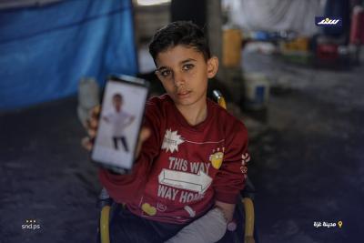 الطفل محمد المبيض.. قدم مبتورة ورسمة أمل في وجه الحرب2.jpg