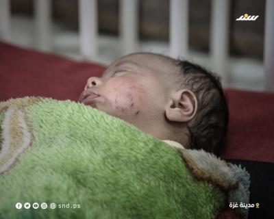 إصابة رضيع بعضة فأر بغزة  (5).jpg