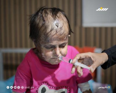 الفتاة سندس الجروشة تواجه مرضًا نادرًا وسوء تغذية يلتهم جسدها7.jpg