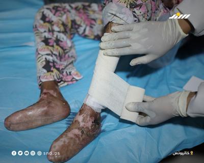 الفتاة سندس الجروشة تواجه مرضًا نادرًا وسوء تغذية يلتهم جسدها2.jpg