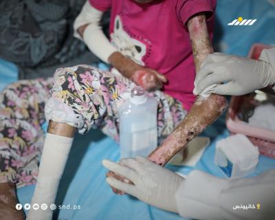 الفتاة سندس الجروشة تواجه مرضًا نادرًا وسوء تغذية يلتهم جسدها4.jpg