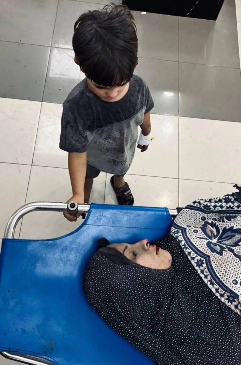 طفل يتمسك بأمه الجريحة.JPG