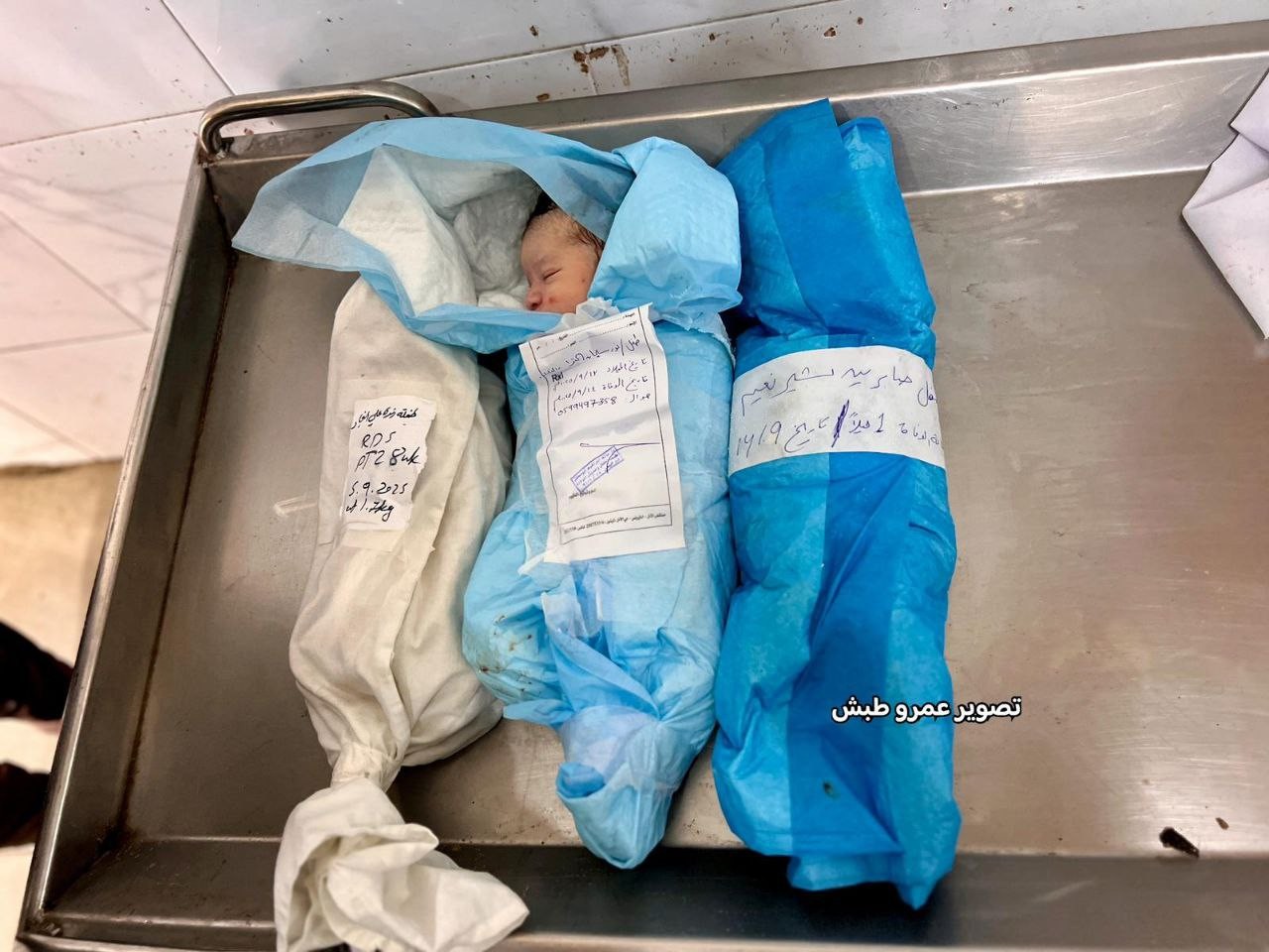 وفاة 7 أطفال في مجمع ناصر  (2).jpg