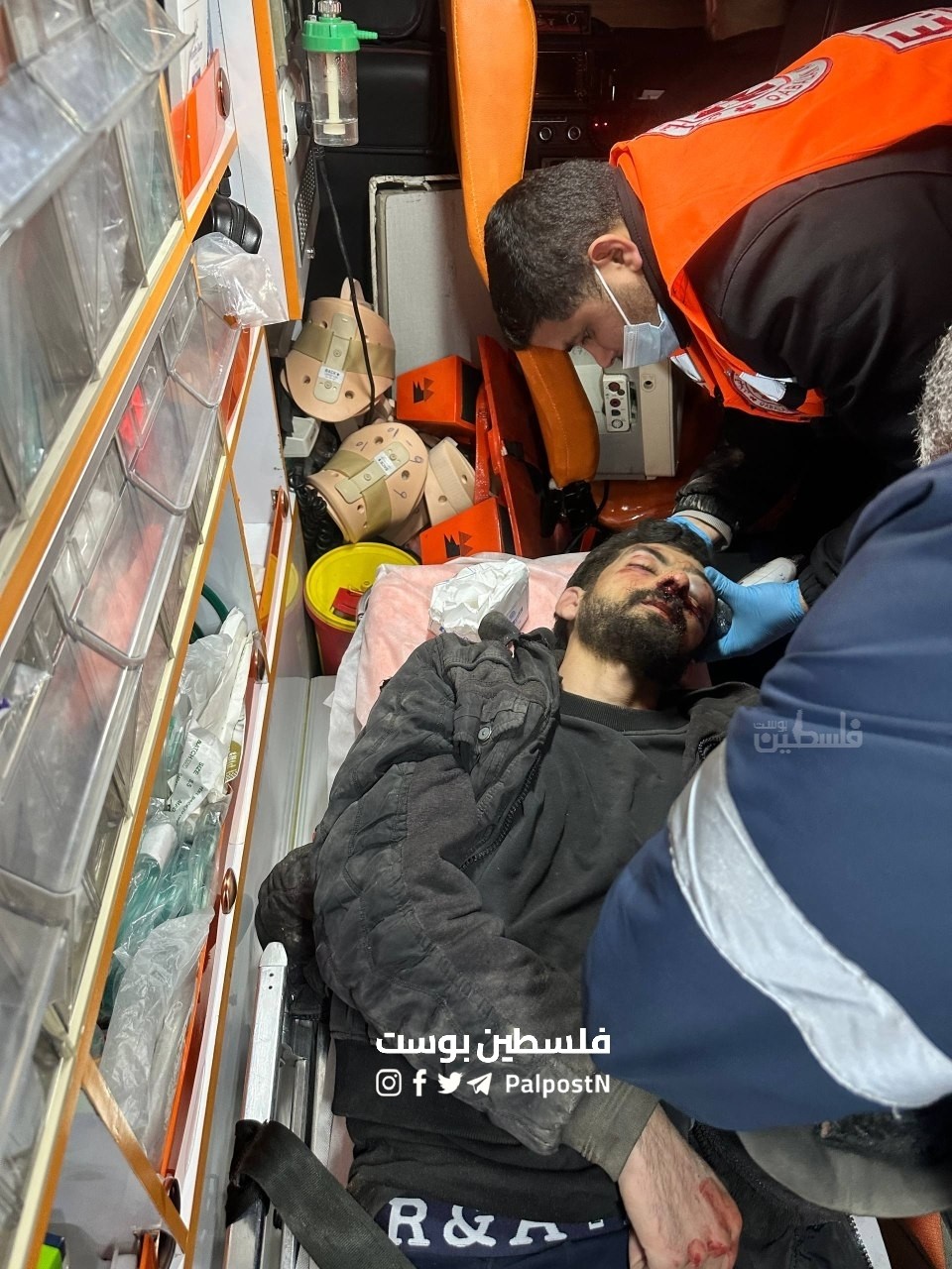 إصابة شاب باعتداء مستوطنين في قصرة (1).jpeg