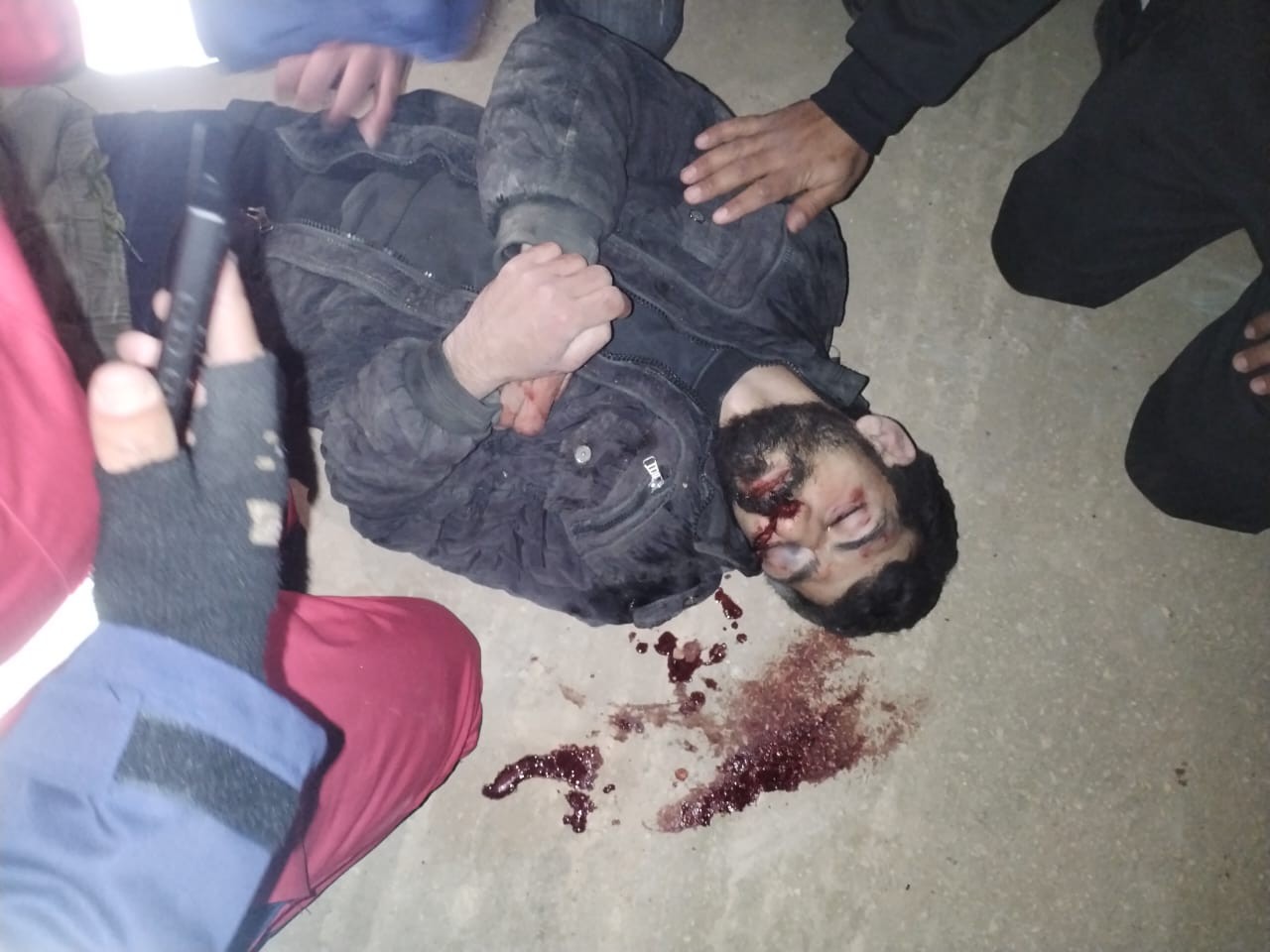 إصابة شاب باعتداء مستوطنين في قصرة  (2).jpeg