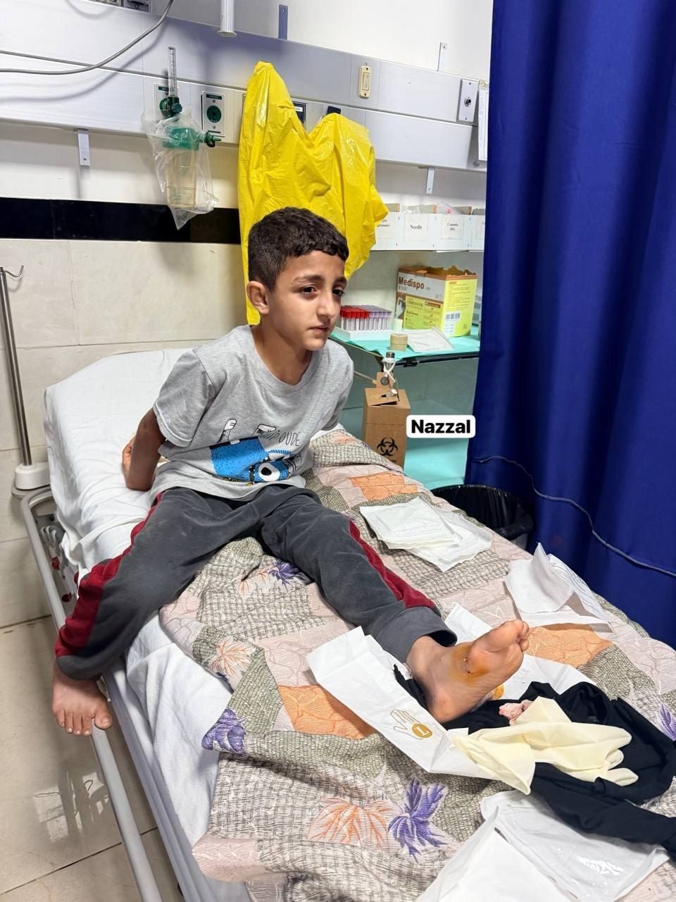 إصابة طفل بشظية برصاص الاحتلال في قلقيلية.jpeg