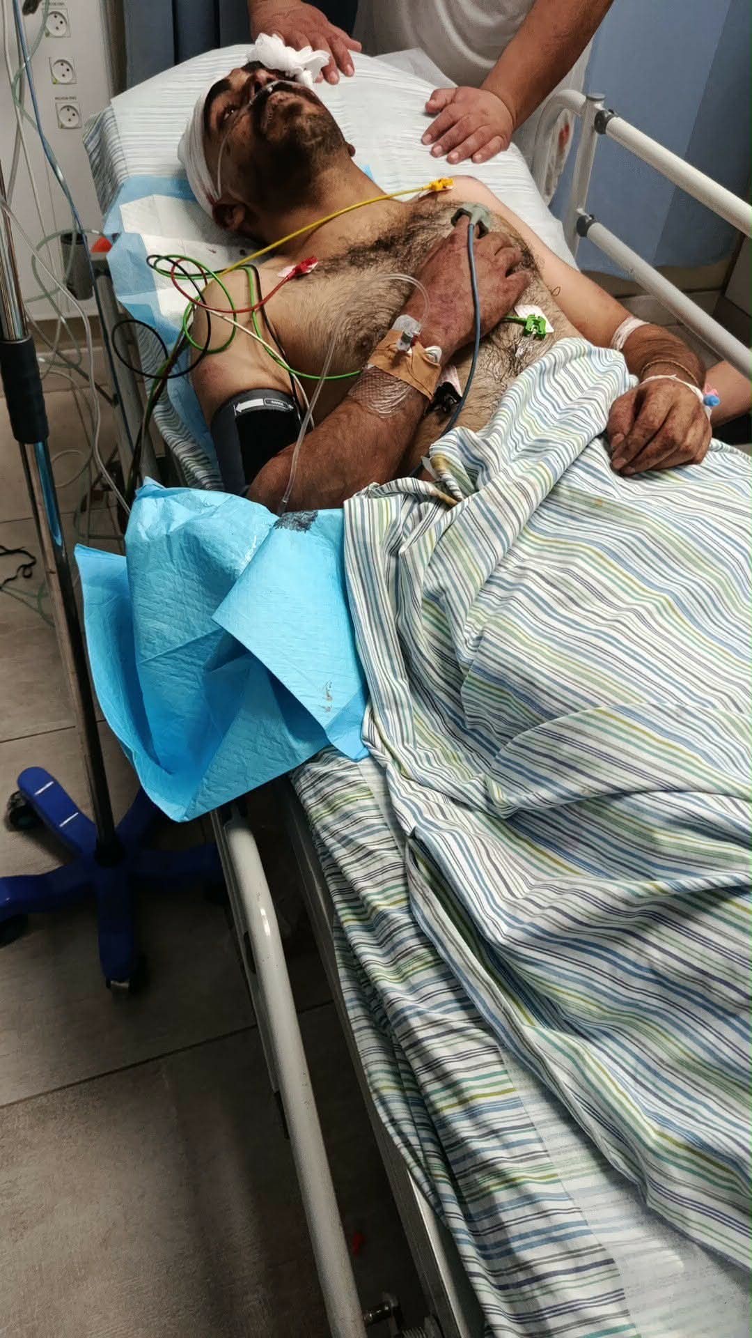 إصابة شاب باعتداء للمستوطنين شمال رام الله.jpg