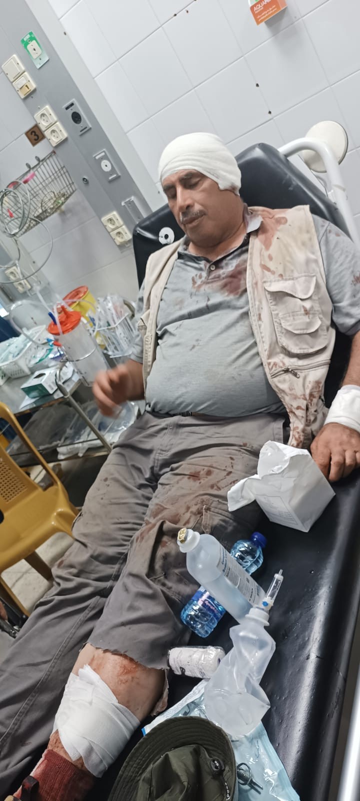 إصابة مواطن باعتداء المستوطنين.jpg